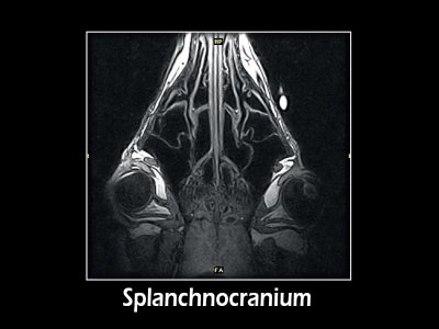 GE 3D T1 dorzalna, splanhnokranij